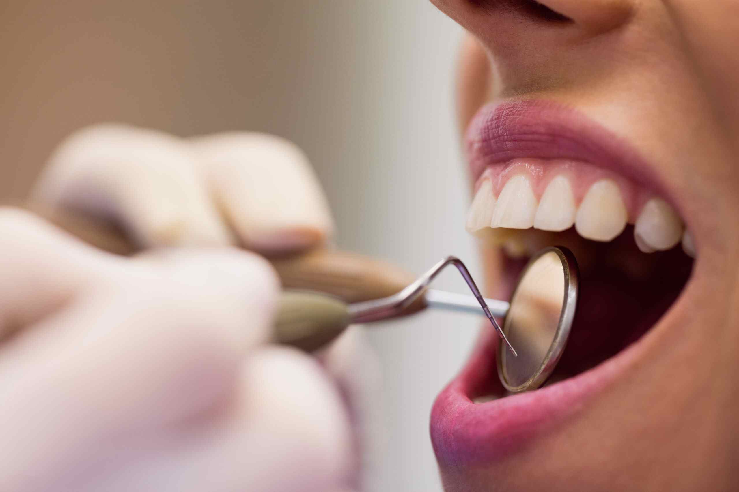 General dentistry at Apex Dentistry & Implants