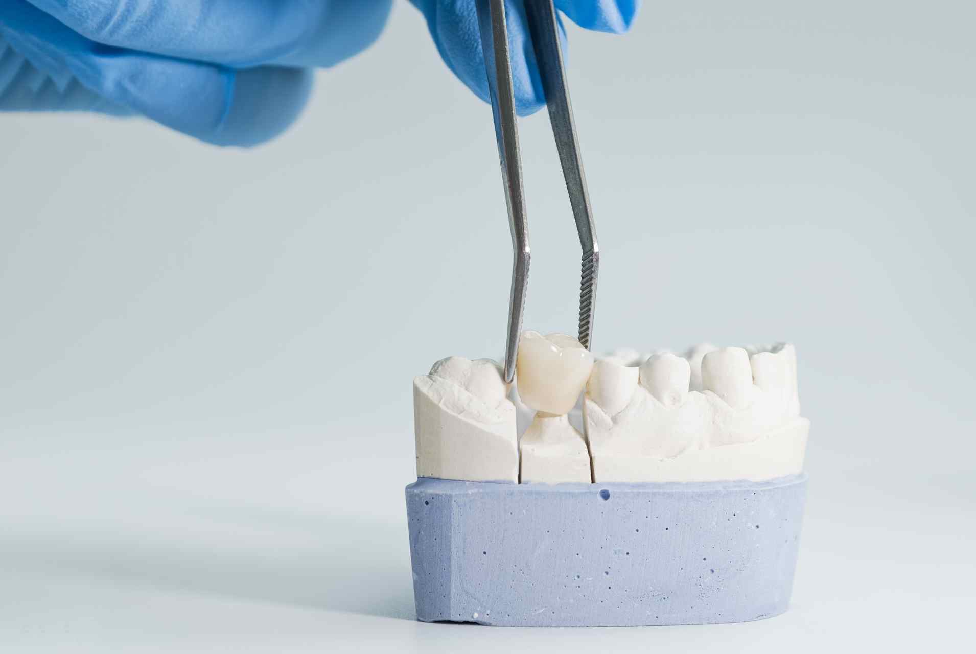 Restorative dentistry